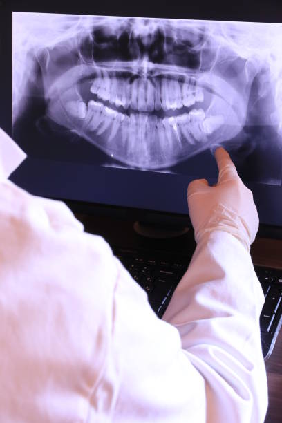 Best Emergency Treatment for Dental Infections or Abscesses in Gold River, CA